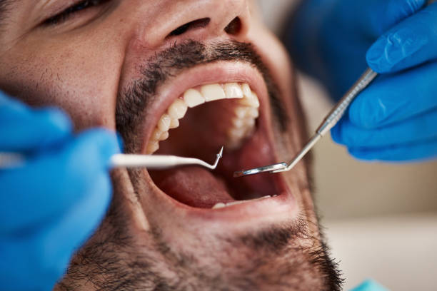 Best Dental Inlays and Onlays  in Moscow, ID